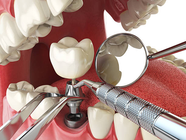 Best Emergency Dental Services for Seniors in North Hartsville, SC